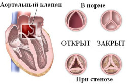 lijevi ventrikularni tlak i aorte se
